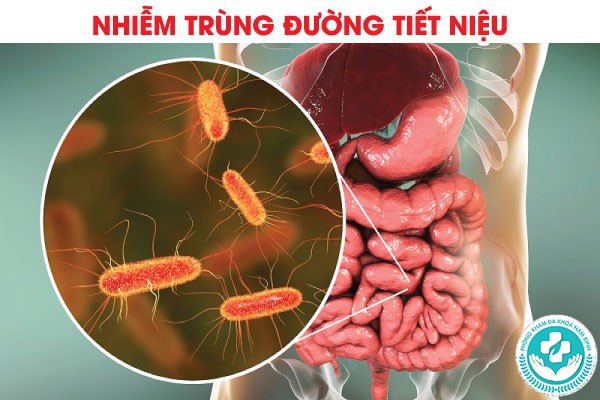 đi tiêu buốt sau quan hệ