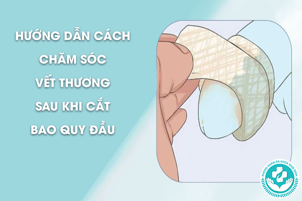 Địa chỉ cắt bao quy đầu tại Nho Quan