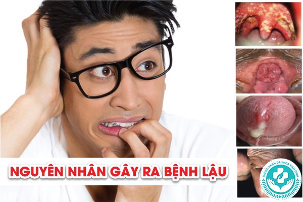 Địa chỉ chữa bệnh lậu tại Duy Tiên