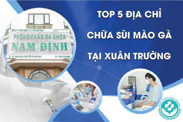 địa chỉ chữa sùi mào gà tại Xuân Trường