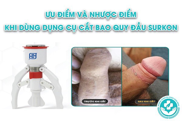 dụng cụ cắt bao quy đầu surkon