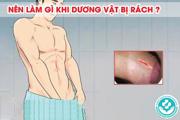 dương vật bị rách dương vật bị rách