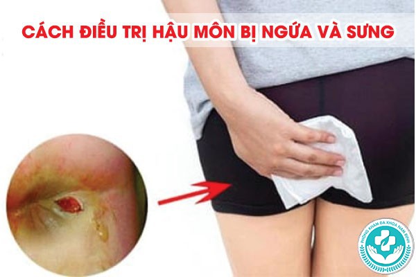 hậu môn bị ngứa và sưng
