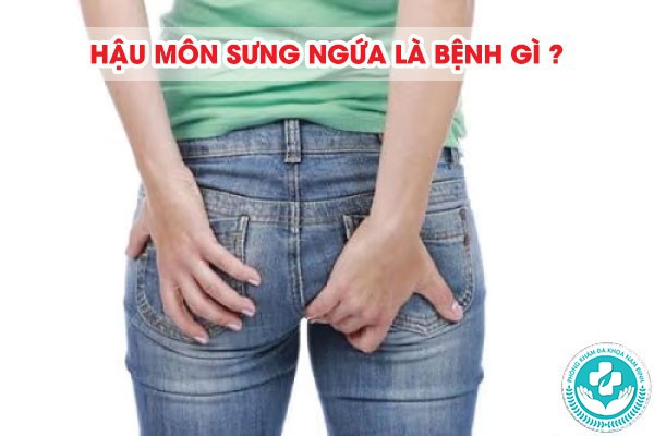 Hậu môn sưng ngứa là bệnh gì