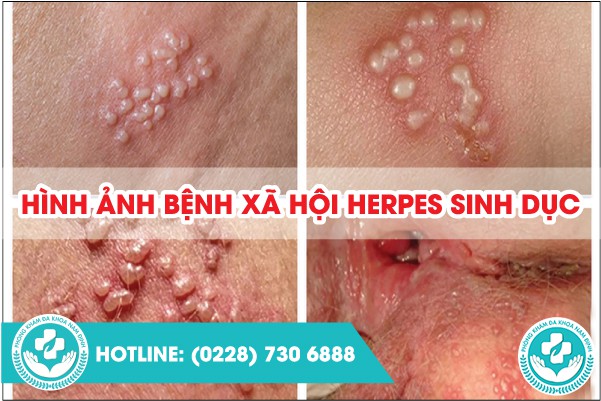 hình ảnh bệnh xã hội