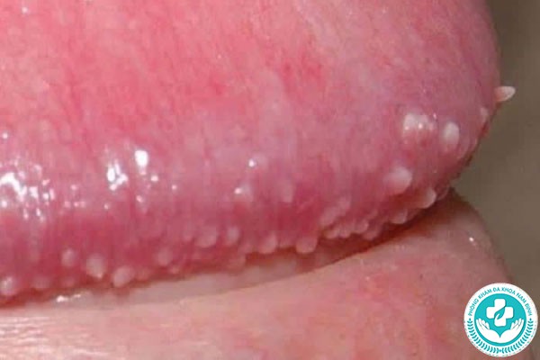 hình ảnh chuỗi hạt ngọc dương vật