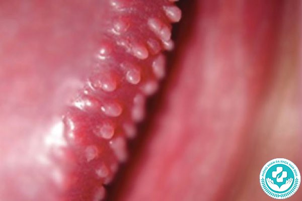 hình ảnh chuỗi hạt ngọc dương vật