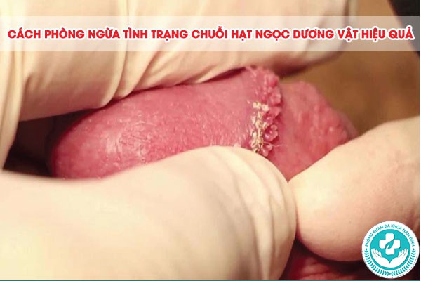hình ảnh chuỗi hạt ngọc dương vật