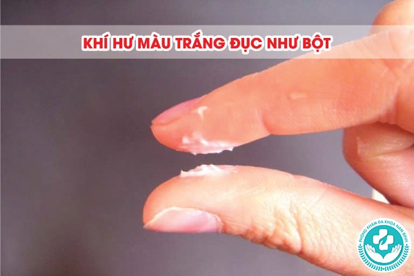 hình ảnh khí hư bất thường