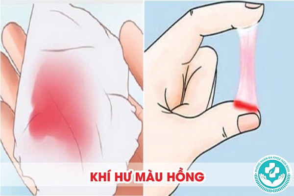 hình ảnh khí hư bất thường