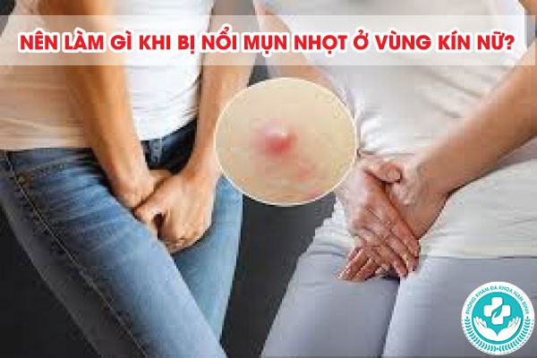 hình ảnh nổi mụn nhọt ở vùng kín nữ