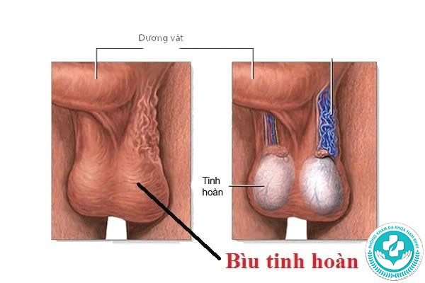 hình ảnh tinh hoàn bình thường hình ảnh tinh hoàn bình thường