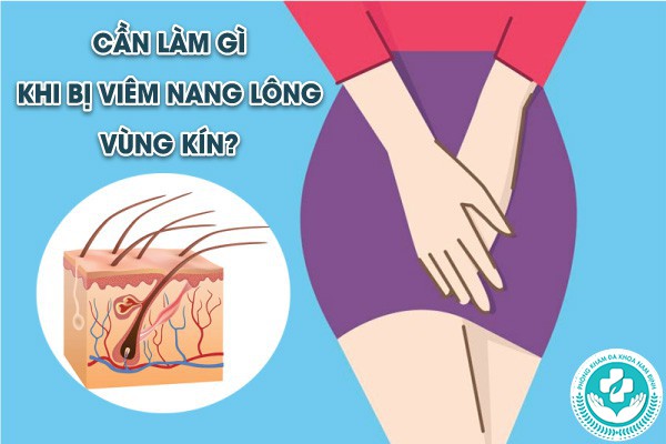 hình ảnh viêm nang lông vùng kín