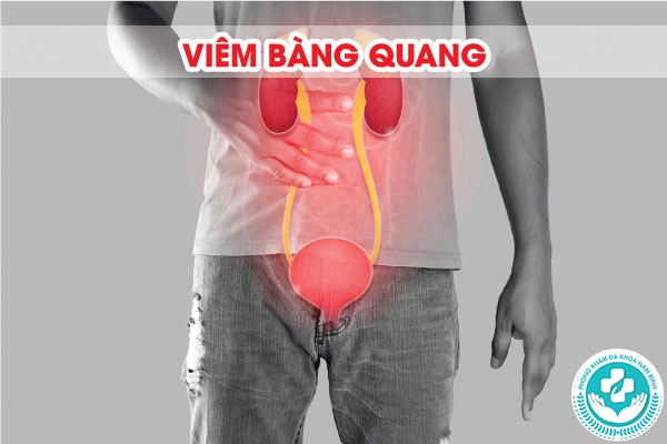hình ảnh viêm nhiễm nam khoa