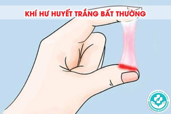 khí hư huyết trắng bất thường