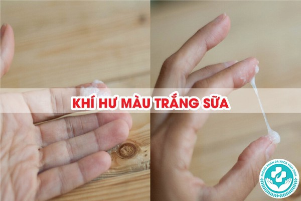 khí hư màu trắng sữa