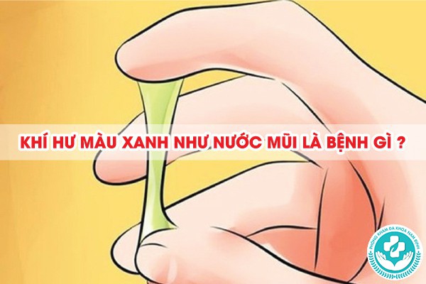 khí hư màu xanh như nước mũi