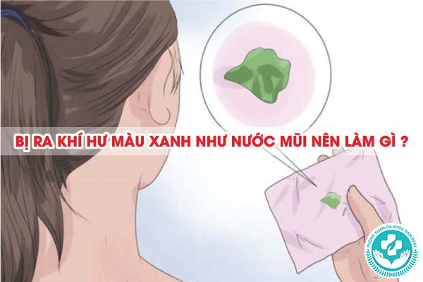 khí hư màu xanh như nước mũi