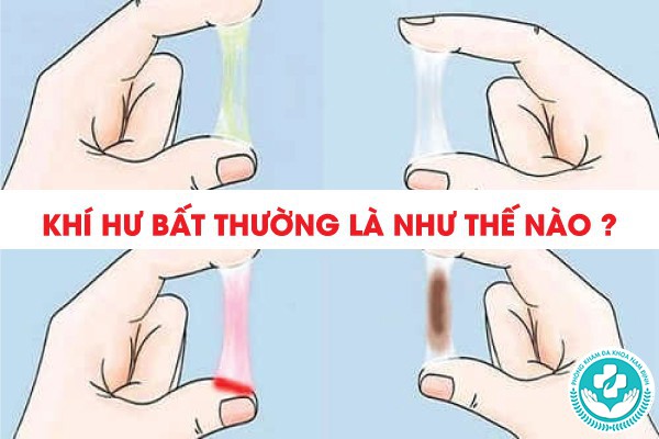 khí hư như nào là bình thường