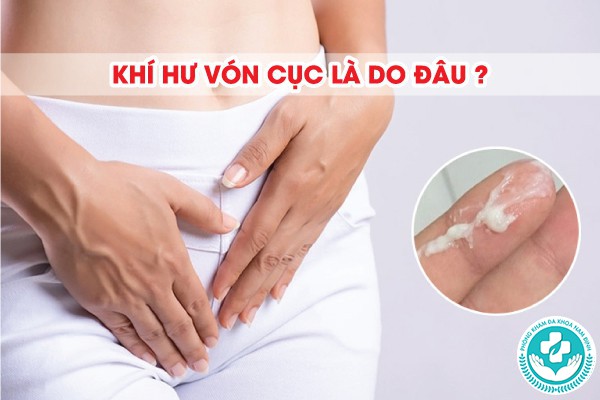 khí hư vón cục