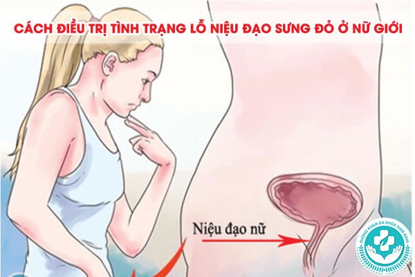 lỗ niệu đạo sưng đỏ ở nữ