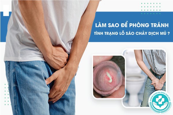 lỗ sáo chảy dịch mủ