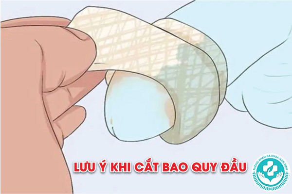 lưu ý khi cắt bao quy đầu