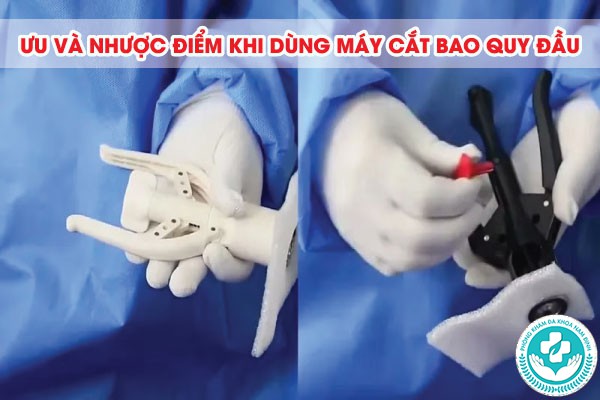máy cắt bao quy đầu máy cắt bao quy đầu