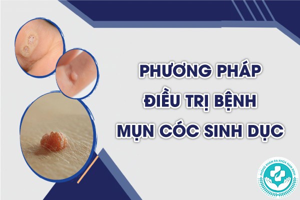 mụn cóc sinh dục