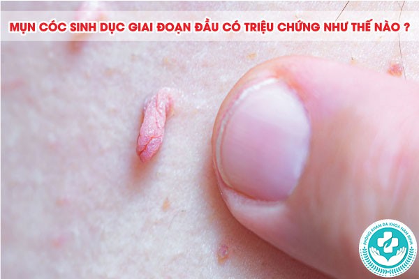 mụn cóc sinh dục giai đoạn đầu