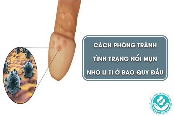 mụn nhỏ li ti ở bao quy đầu