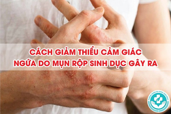 mụn rộp sinh dục có ngứa không