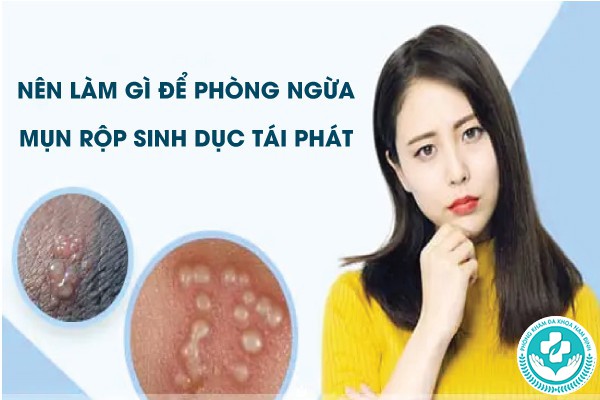 mụn rộp sinh dục có tái phát không