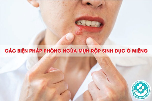 mụn rộp sinh dục ở miệng