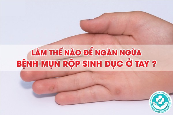 mụn rộp sinh dục ở tay