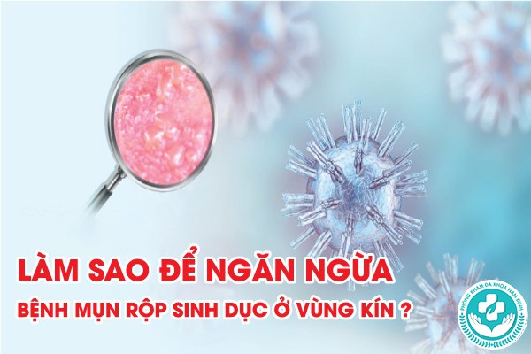 mụn rộp sinh dục ở vùng kín