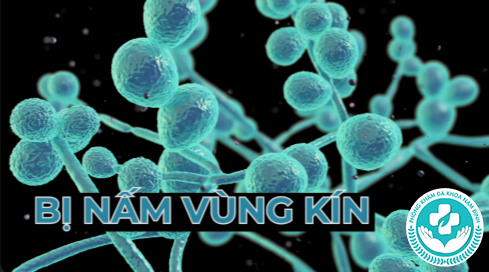 Nấm vùng kín nữ có tự khỏi không