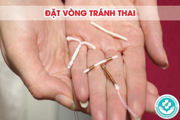 nên đặt vòng hay tiêm thuốc tránh thai