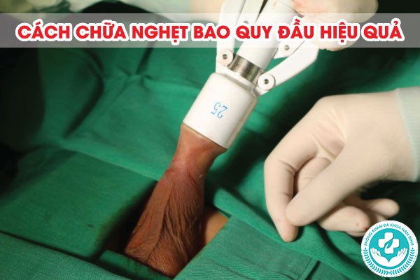 nghẹt bao quy đầu nghẹt bao quy đầu