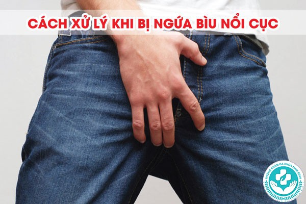 Ngứa bìu nổi cục Ngứa bìu nổi cục