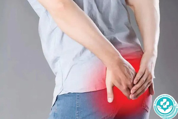 Ngứa hậu môn Ngứa hậu môn