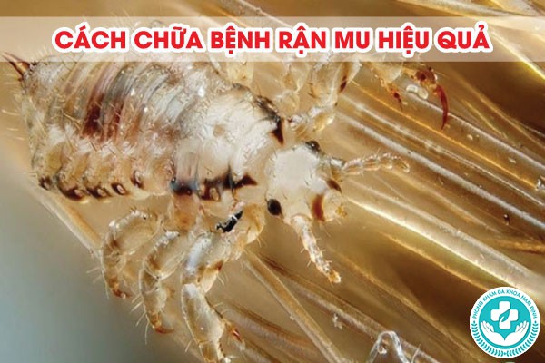 nguyên nhân bị rận mu
