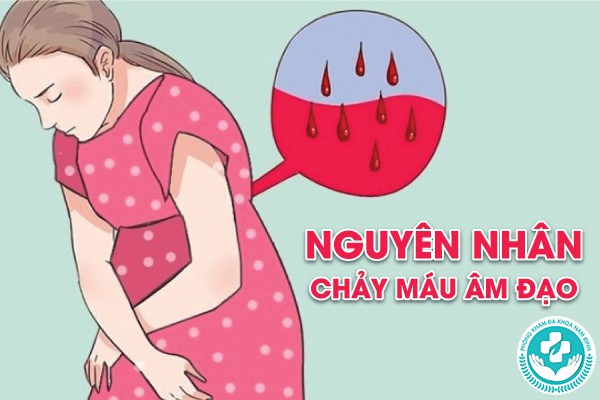 nguyên nhân chảy máu âm đạo