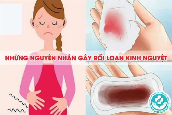 rối loạn kinh nguyệt uống thuốc gì