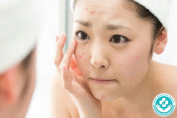 nhược điểm của đặt vòng tránh thai