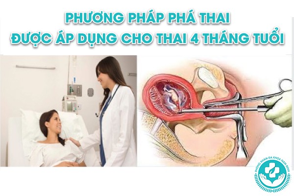 phá thai 4 tháng tuổi có đau không