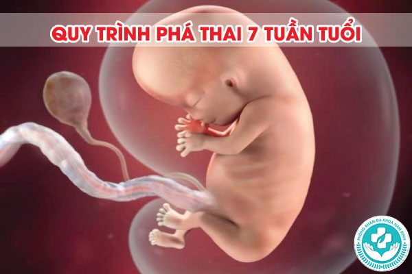 phá thai 7 tuần