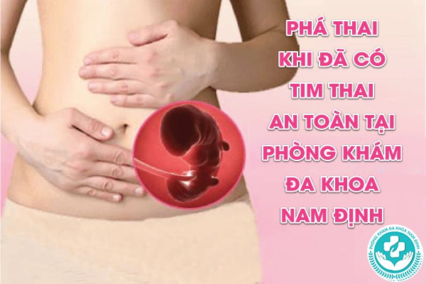 phá thai khi có tim thai