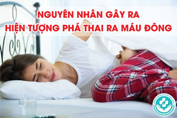 phá thai ra máu đông