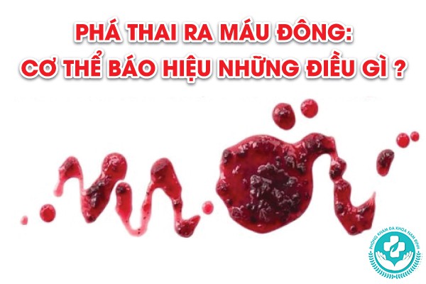 phá thai ra máu đông